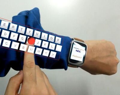 /pf/resources/images/abc-placeholder.png?d=2393