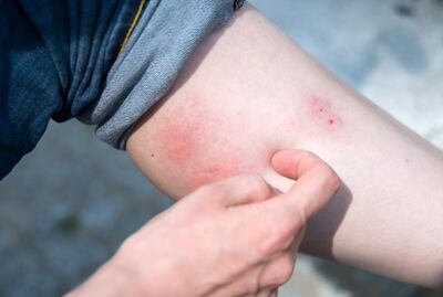 /pf/resources/images/abc-placeholder.png?d=2395