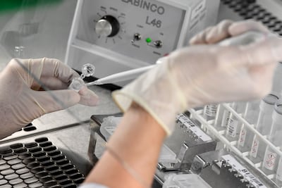 Dos personas que dieron positivo al COVID-19 salieron de sus domicilios pese a la prohibición de salir.