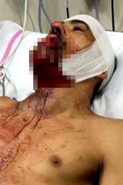 /pf/resources/images/abc-placeholder.png?d=2421