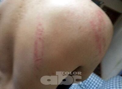 /pf/resources/images/abc-placeholder.png?d=2393