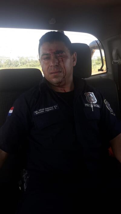 Policía herido tras el enfrentamiento con los labriegos.