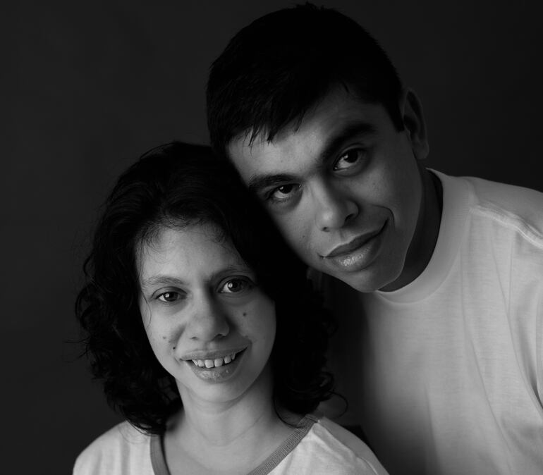 Las personas con este síndrome necesitan del acompañamiento de un adulto siempre.