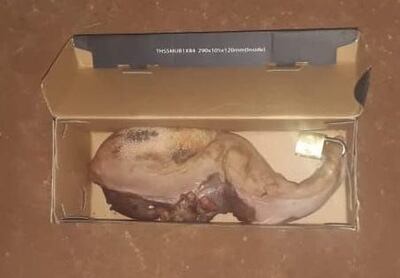 /pf/resources/images/abc-placeholder.png?d=2429