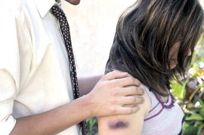 /pf/resources/images/abc-placeholder.png?d=2396