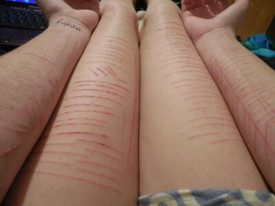 /pf/resources/images/abc-placeholder.png?d=2395