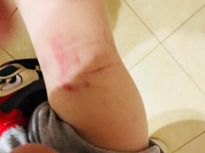 /pf/resources/images/abc-placeholder.png?d=2394