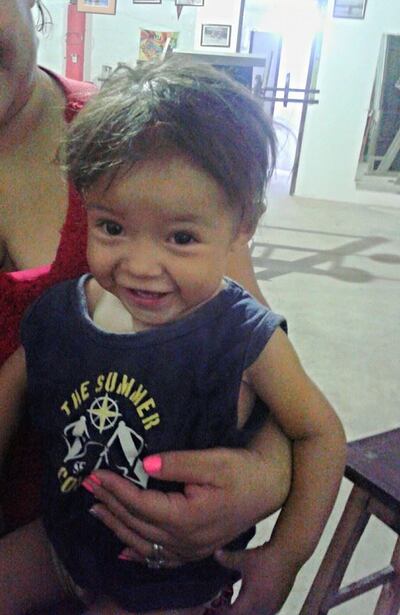 /pf/resources/images/abc-placeholder.png?d=2445