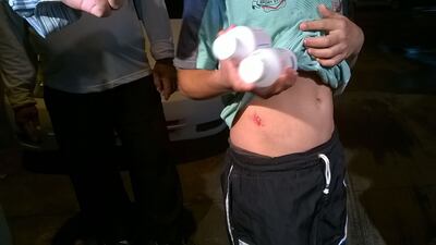 /pf/resources/images/abc-placeholder.png?d=2395