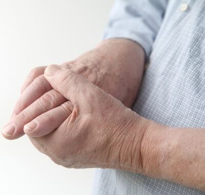 En el Paraguay, la artritis aqueja a al menos 70.000 personas.