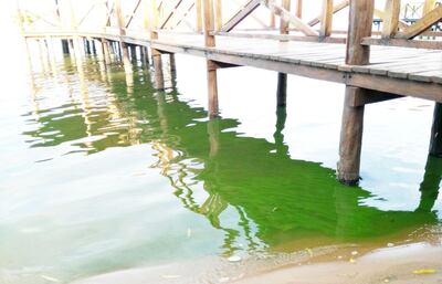 /pf/resources/images/abc-placeholder.png?d=2429