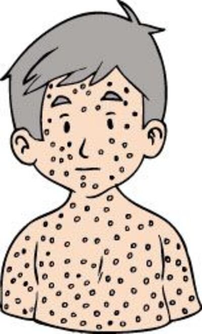 /pf/resources/images/abc-placeholder.png?d=2393