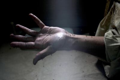 /pf/resources/images/abc-placeholder.png?d=2395