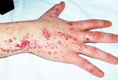 /pf/resources/images/abc-placeholder.png?d=2394