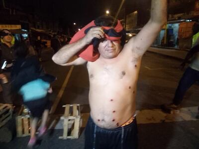 /pf/resources/images/abc-placeholder.png?d=2393