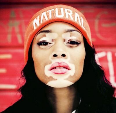 Imagen sin descripción