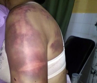 /pf/resources/images/abc-placeholder.png?d=2393