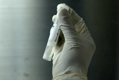 Una muestra tomada a un paciente para corroborar si tiene coronavirus.