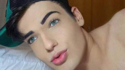 /pf/resources/images/abc-placeholder.png?d=2395