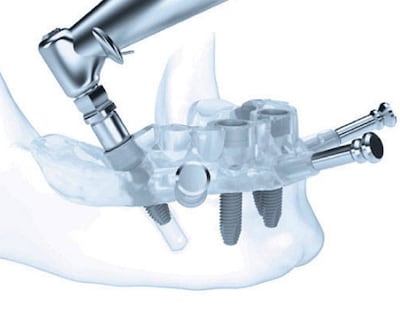 /pf/resources/images/abc-placeholder.png?d=2394