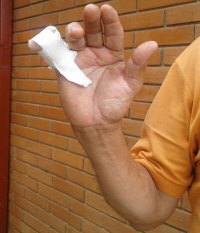 /pf/resources/images/abc-placeholder.png?d=2393