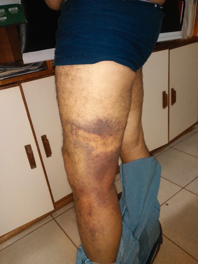 El hombre tiene golpes en todo el  cuerpo.