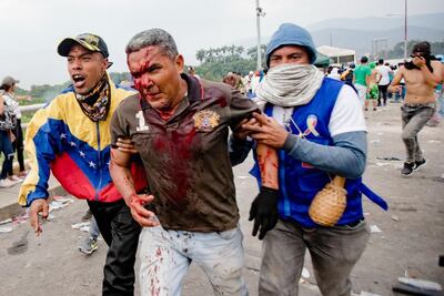 /pf/resources/images/abc-placeholder.png?d=2394