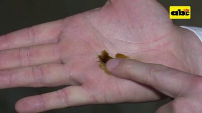 /pf/resources/images/abc-placeholder.png?d=2417