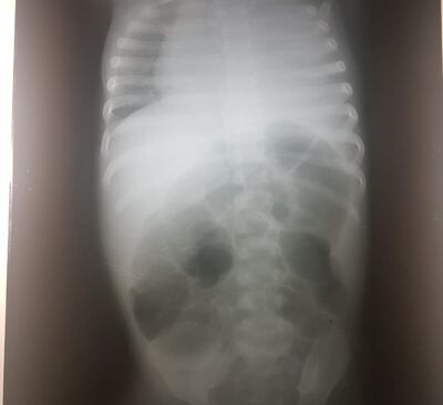 /pf/resources/images/abc-placeholder.png?d=2394