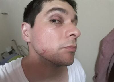 /pf/resources/images/abc-placeholder.png?d=2393