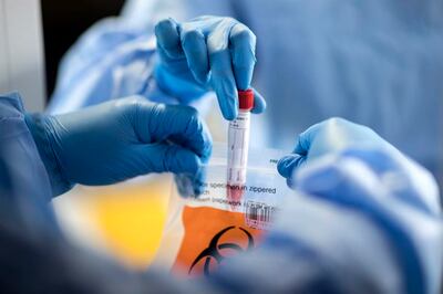 Muestra para un test de coronavirus.