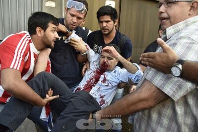 /pf/resources/images/abc-placeholder.png?d=2395