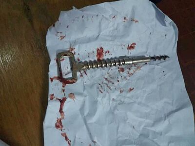 /pf/resources/images/abc-placeholder.png?d=2421