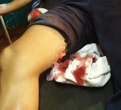 /pf/resources/images/abc-placeholder.png?d=2394