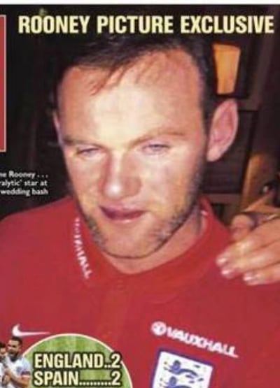 /pf/resources/images/abc-placeholder.png?d=2393