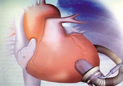 /pf/resources/images/abc-placeholder.png?d=2395