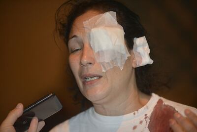 /pf/resources/images/abc-placeholder.png?d=2398