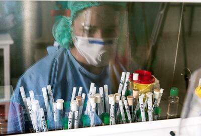 Análisis de muestras en busca de coronavirus.