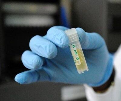 /pf/resources/images/abc-placeholder.png?d=2422