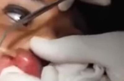 /pf/resources/images/abc-placeholder.png?d=2421