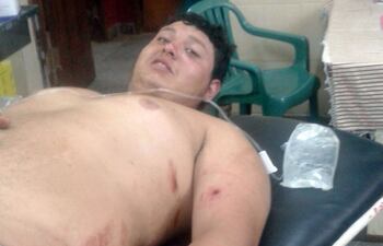 el-joven-baleado-armando-martinez-gonzalez-en-el-momento-en-que-llego-al-hospital-distrital-de-carapegua--235603000000-1424009.jpg