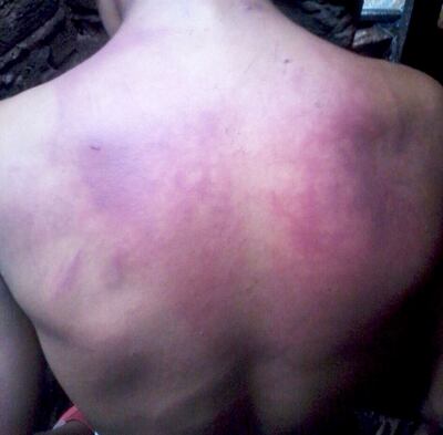 /pf/resources/images/abc-placeholder.png?d=2393