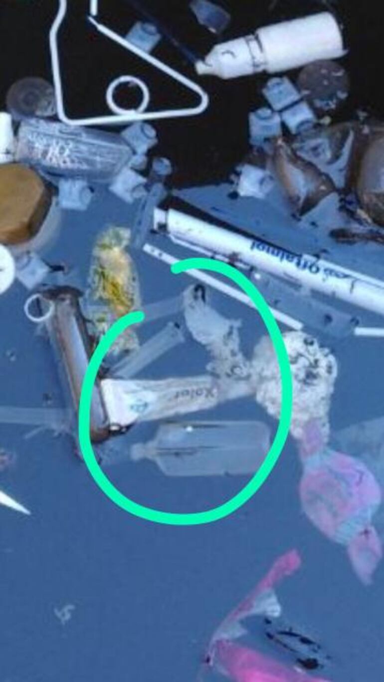 Según el doctor Macchi, el residuo marcado en la foto es de un medicamento oftalmológico.