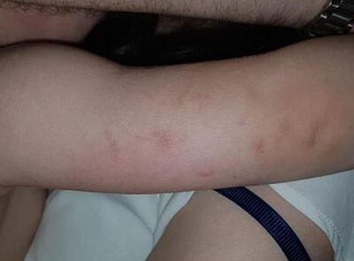 /pf/resources/images/abc-placeholder.png?d=2395