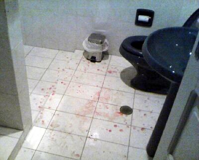 /pf/resources/images/abc-placeholder.png?d=2393