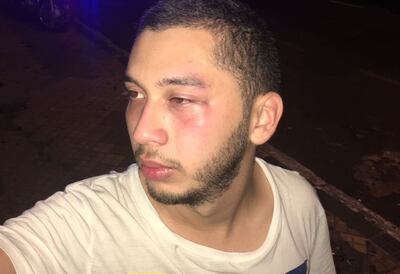 /pf/resources/images/abc-placeholder.png?d=2419