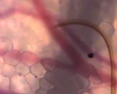 /pf/resources/images/abc-placeholder.png?d=2395