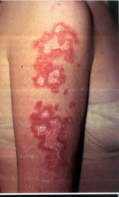 /pf/resources/images/abc-placeholder.png?d=2393