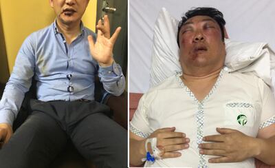 Alfredo Kim (i), quién afirma haber sido amenazado de muerte con un arma cargada. Por su parte, Martín Kim (d) quedó con varias lesiones en el rosto.