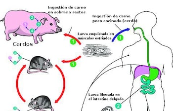 trichinellosis-93622000000-1413063.jpg